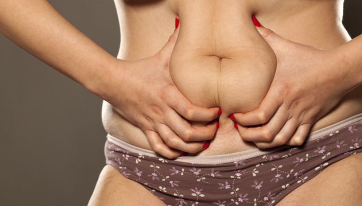 Obezite cerrahisi hakkında bilinmesi gerekenler | TurkArama Motoru | Sağlık ve Günlük Yaşam için Pratik Bilgiler